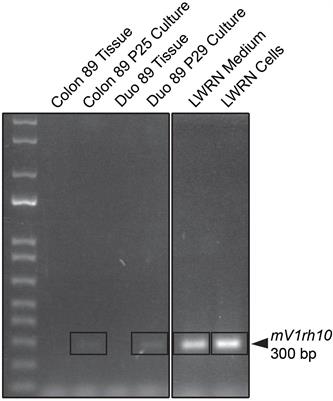 Low-Level Mouse DNA in Conditioned Medium Generates False Positive Cross-Species Contamination Results in Human Organoid Cultures